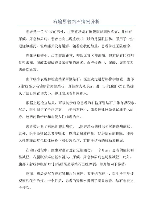 右输尿管结石病例分析