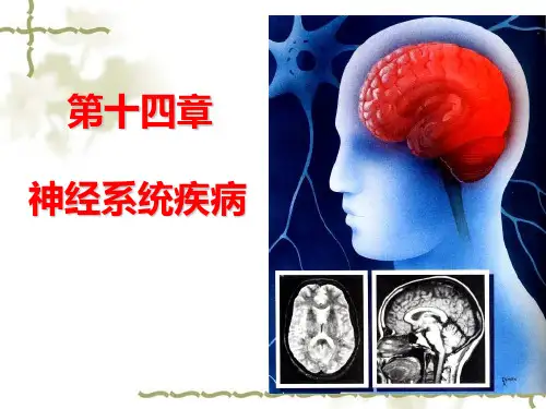 流脑乙脑_精品文档