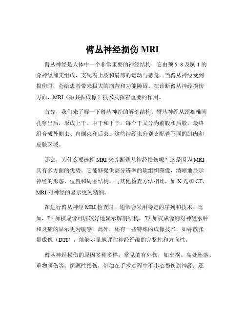 臂丛神经损伤MRI
