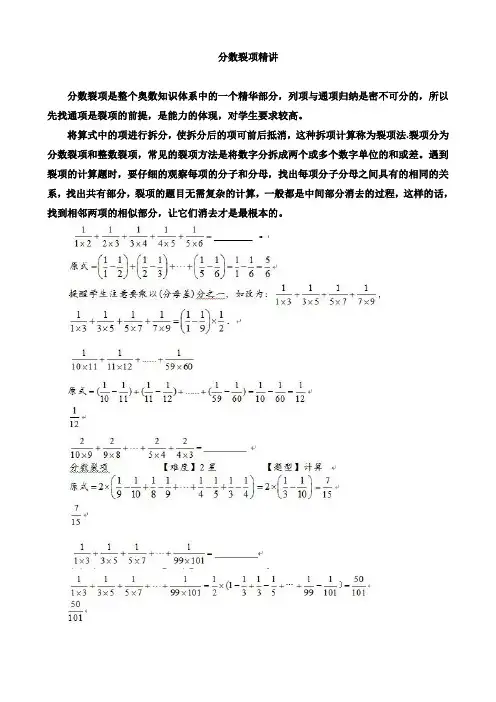 分数裂项精讲