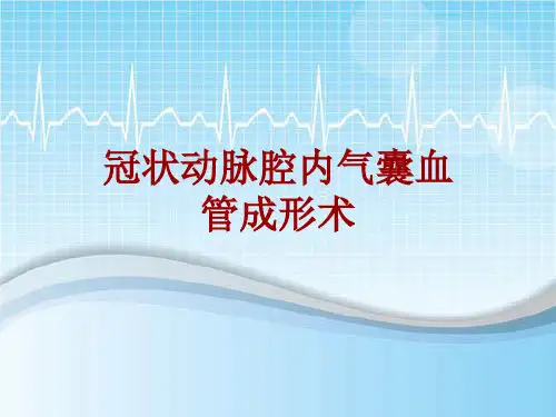 手术讲解模板：冠状动脉腔内气囊血管成形术
