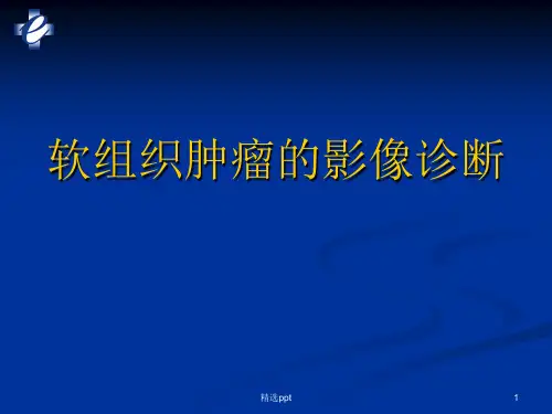 软组织肿瘤MRI