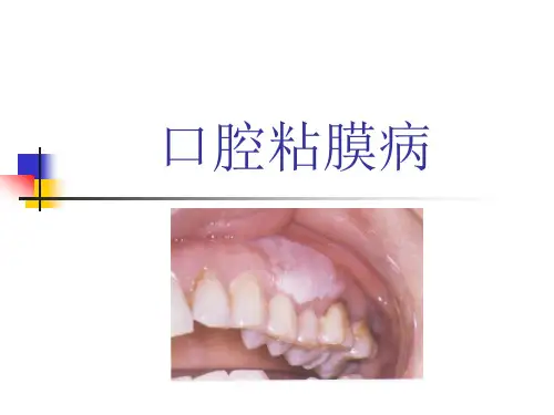 口腔粘膜病