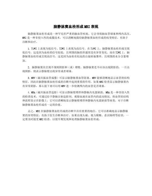 脑静脉窦血栓形成MRI表现