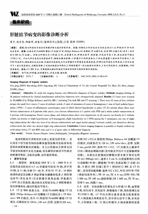 肝脏结节病变的影像诊断分析