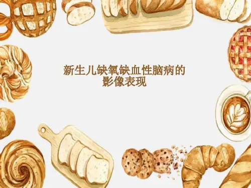 新生儿缺氧缺血性脑病的影像表现