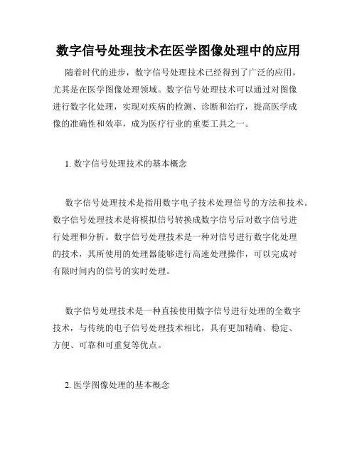 数字信号处理技术在医学图像处理中的应用
