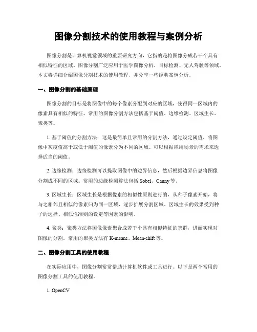图像分割技术的使用教程与案例分析