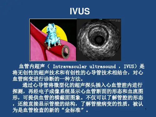 血管内超声在冠脉介入中的临床应用PPT演示课件