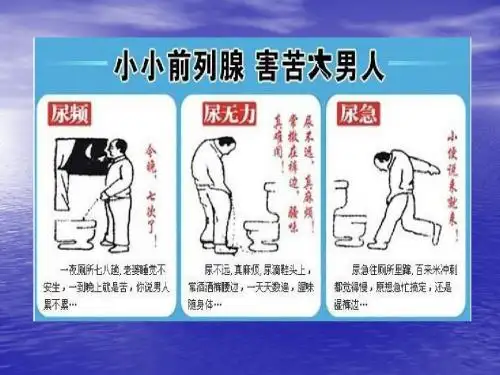 前列腺增生症术后护理PPT课件