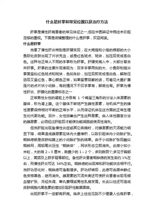什么是肝掌和常见位置以及治疗方法