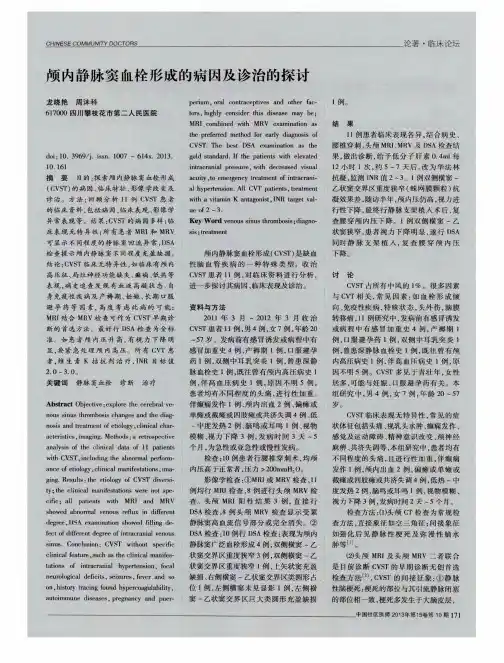 颅内静脉窦血栓形成的病因及诊治的探讨