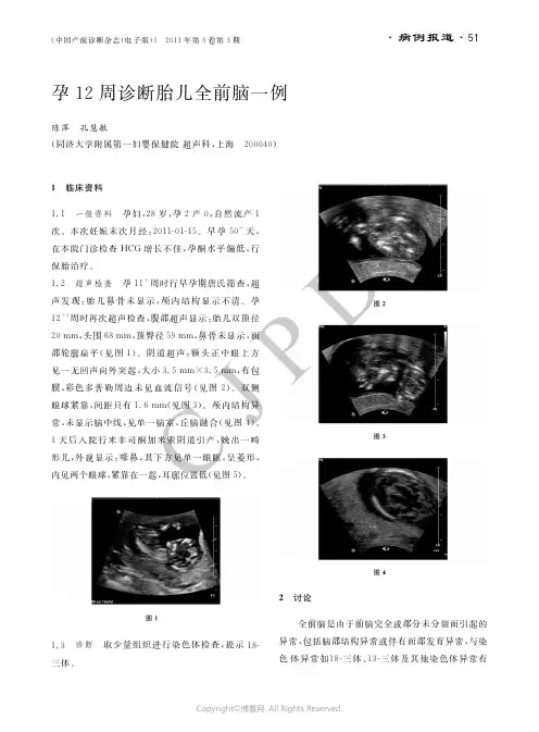 26993129_孕12周诊断胎儿全前脑一例