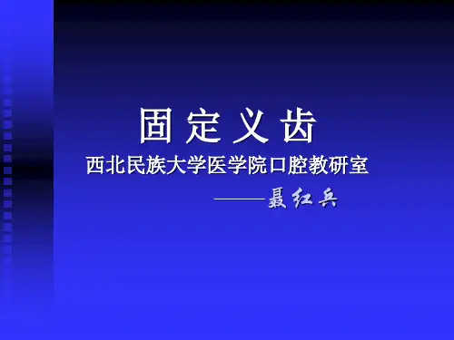 第六章 固定桥