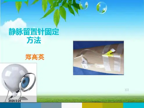 留置针固定