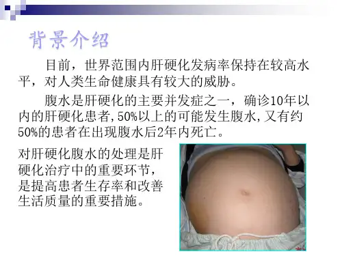 医学专题欧肝和美肝指南比较ppt