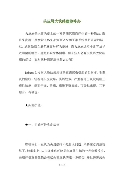 头皮屑大块结痂该咋办