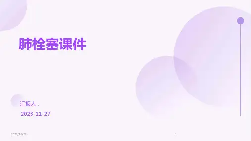 肺栓塞课件ppt课件
