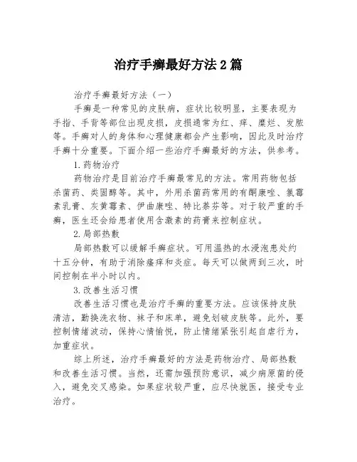 治疗手癣最好方法2篇