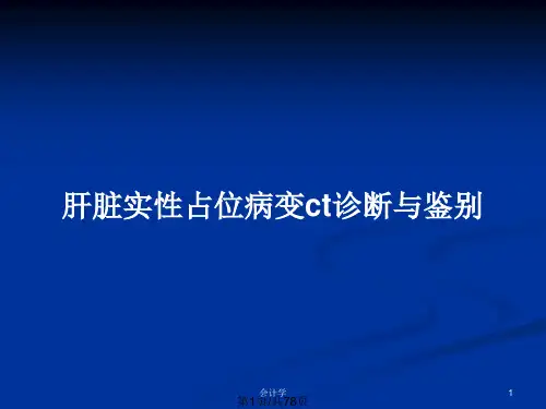 肝脏实性占位病变ct诊断与鉴别PPT教案