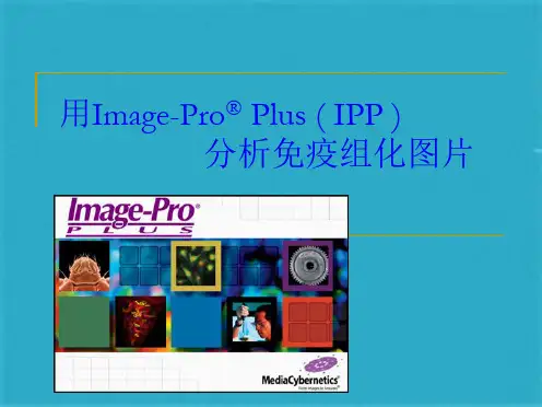 IPP 分析免疫组化图片(共61张PPT)