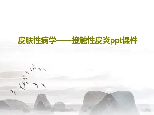 皮肤性病学——接触性皮炎ppt课件共30页文档