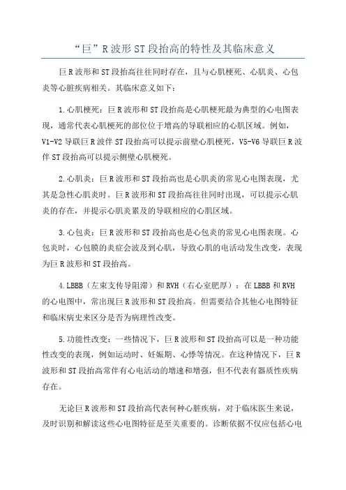 “巨”R波形ST段抬高的特性及其临床意义