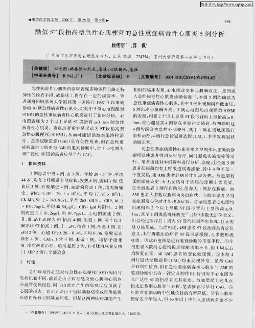 酷似ST段抬高型急性心肌梗死的急性重症病毒性心肌炎5例分析