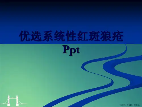 系统性红斑狼疮