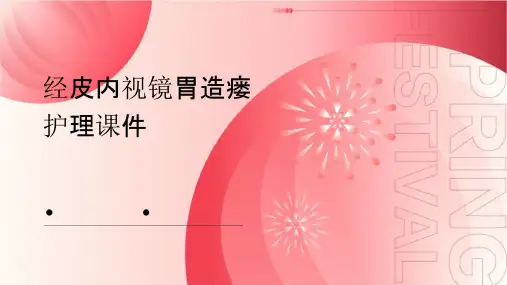 经皮内视镜胃造瘘护理课件