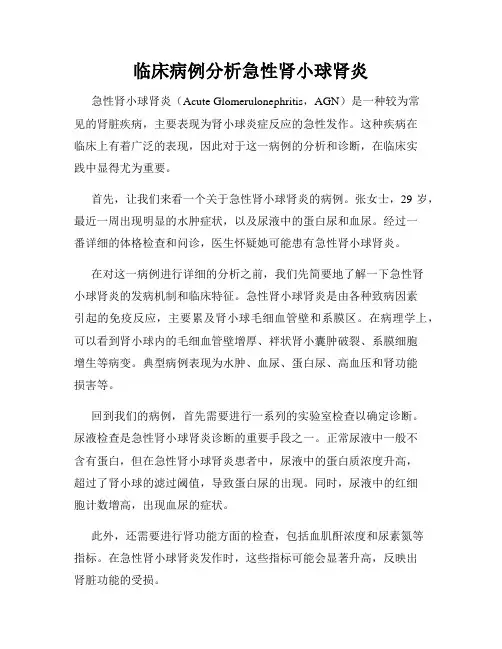 临床病例分析急性肾小球肾炎