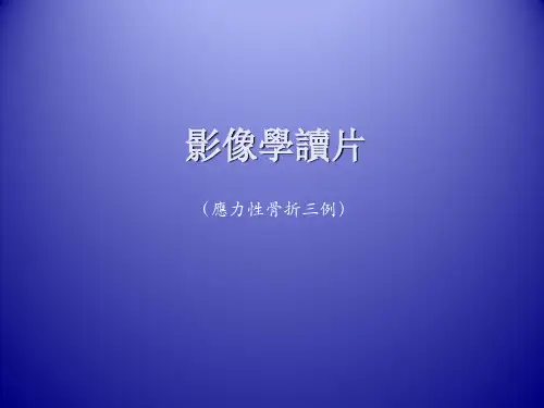 影像学病例读片-应力性骨折
