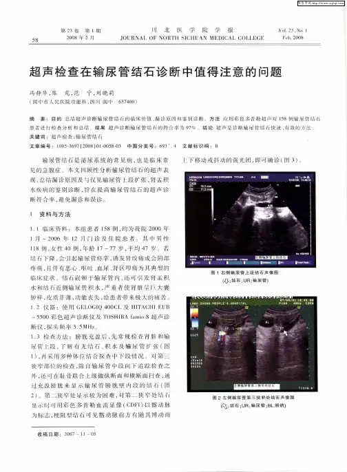 超声检查在输尿管结石诊断中值得注意的问题
