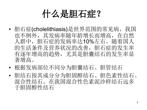 (精选课件)胆结石讲稿PPT幻灯片