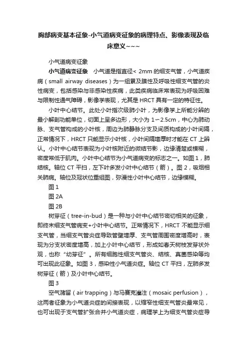 胸部病变基本征象-小气道病变征象的病理特点、影像表现及临床意义~~~