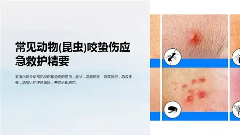 常见动物(昆虫)咬蛰伤应急救护精要