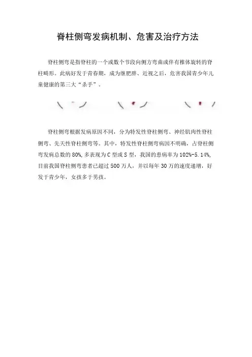 脊柱侧弯发病机制危害及治疗方法