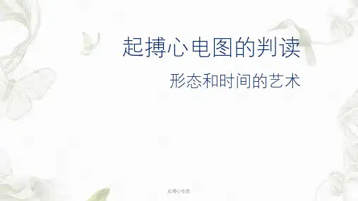 起搏心电图ppt课件