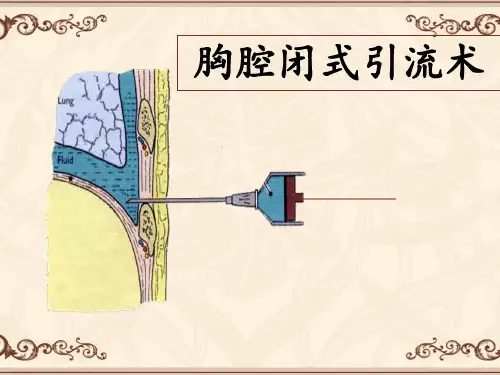胸腔闭式引流术  ppt课件