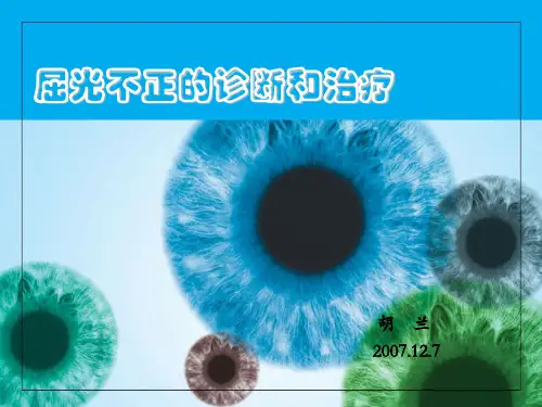 屈光不正的诊断和治疗