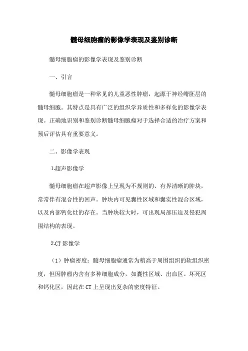髓母细胞瘤的影像学表现及鉴别诊断