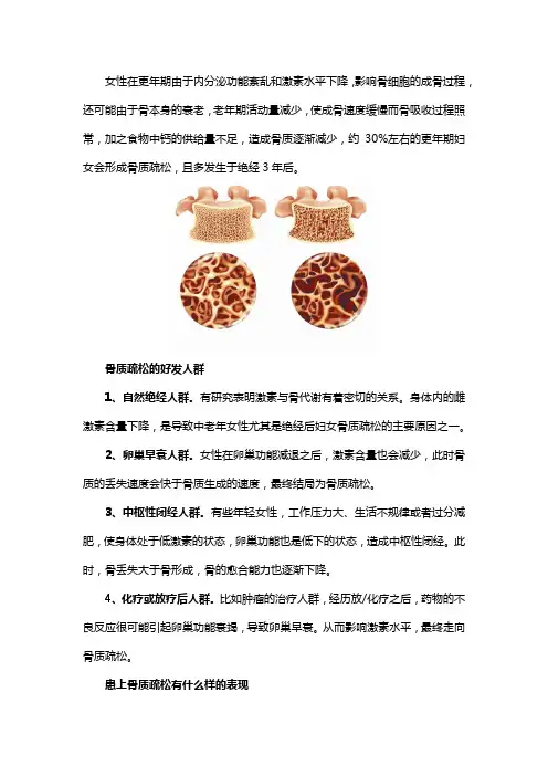 更年期女性更应该关注骨质疏松