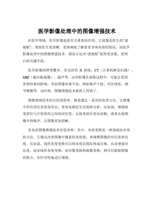 医学影像处理中的图像增强技术