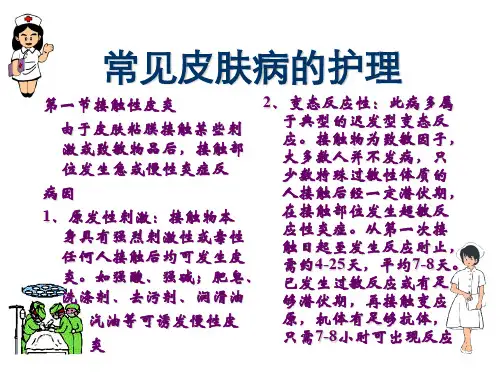 常见皮肤病的护理-PPT课件