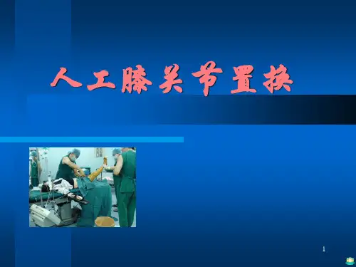 人工膝关节置换 ppt课件