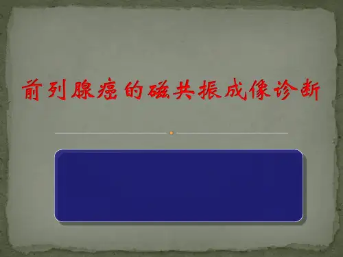 前列腺癌磁共振诊断课件