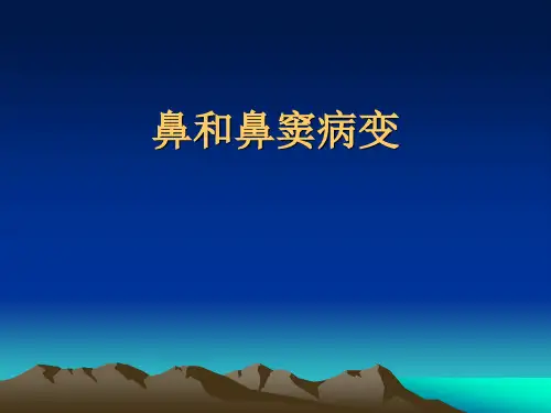 【影像诊断课件】鼻和鼻窦病变