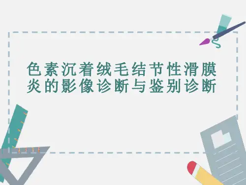 色素沉着绒毛结节性滑膜炎的影像诊断与鉴别诊断