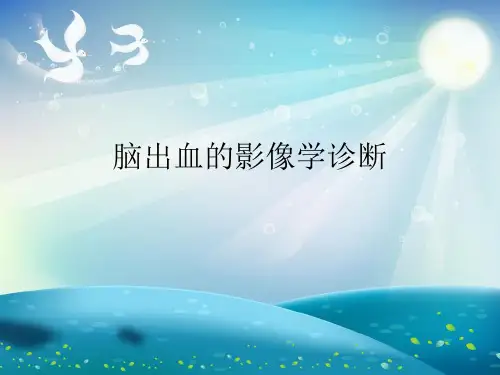 脑出血的影像学诊断PPT课件