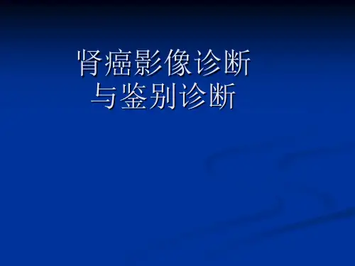 肾癌影像诊断与鉴别诊断 6